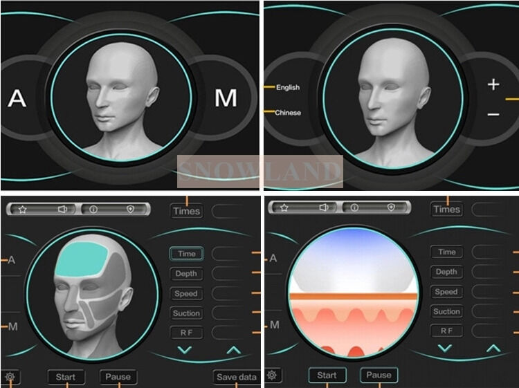 반도체 808nm 레이저 다이오드 레이저 탈모 기계 피부 접촉 센서와 함께 빠른 탈모 치료를 보장